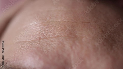Closeup shows soft forehead wrinkles and natural skin texture highlighting early fine lines and subtle aging signs visible clearly in macro when the skin relaxes under neutral lighting