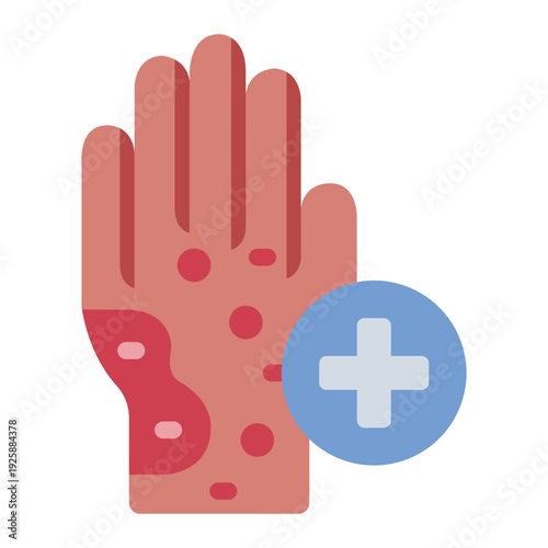allergy flat icon. skin reaction symptom. Hand eczema. medical treatment