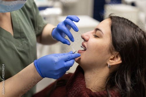 Cuadro en lienzo Orthodontist applying elastic bands on patient's braces