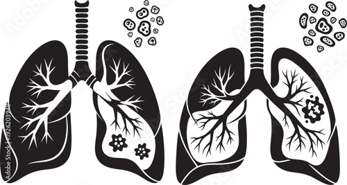 Illustrations of human lungs showing healthy vs diseased state with black outlines and stylized cells, representing respiratory health and illness.