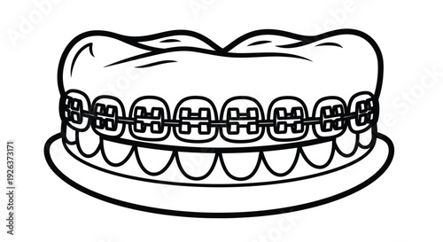 Illustration of teeth with braces depicted in a simple black and white line drawing