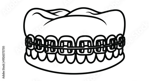 Black and white illustration of teeth with braces depicting orthodontic treatment