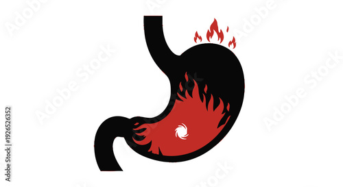 Illustration of a burning stomach depicting heartburn or acid reflux