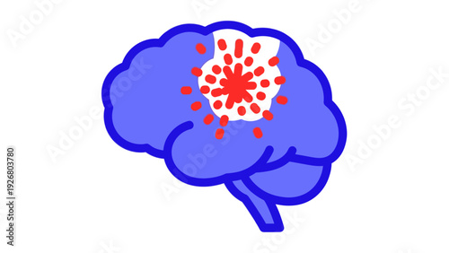 Brain Stroke Vector Illustration - Red Blood Bursting from Damaged Area, Medical Concept for Neurological Disease and Health Crisis