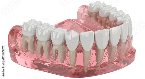 Dental prosthesis model showcasing artificial teeth on pink gums, close-up view from the front