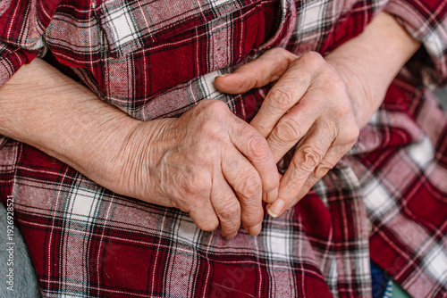 Bild auf Leinwand An elderly woman with rheumatoid arthritis on her hands, joint damage