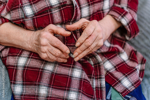 Fotografi An elderly woman with rheumatoid arthritis on her hands, joint damage