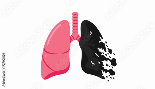 Illustration of a healthy pink lung and a diseased black lung with smoke, on a white background.
