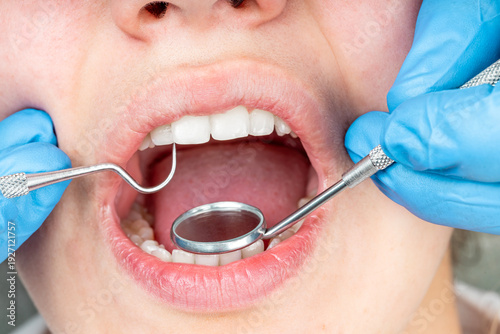 Close-up of dentist examining patient teeth with dental mirror and probe for oral health