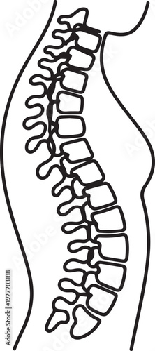 Curvature of the human spine. Scoliosis. One line drawing for different uses. one line art icon drawing vector