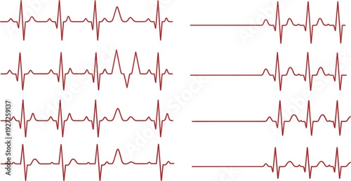 Heartbeat ECG Line Collection with Electrocardiogram Pulse Signals Medical Monitoring Vector Illustration Set