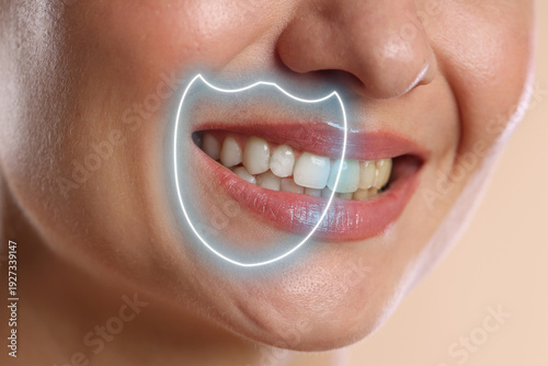 Dental care. Woman with perfect smile on beige background, closeup. Teeth under virtual shield whiter than others