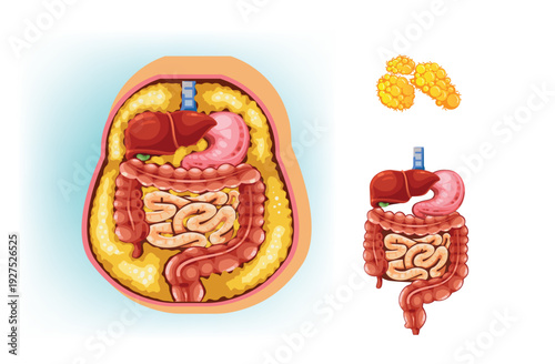 Visceral Fat Surrounding Abdominal Organs