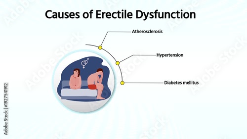 Causes of Erectile Dysfunction in Men – Medical 3D Animation Explaining ED Risk Factors