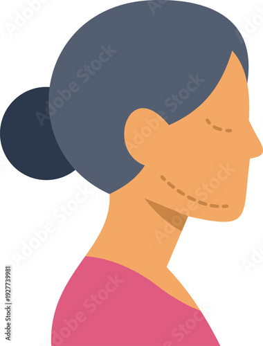 Woman profile with dashed lines indicating plastic surgery procedures on face and neck