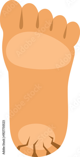 Detailed cartoon illustration showing a human foot sole with dry and cracked heel