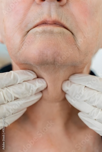 A medical professional palpates the sagging neck skin and double chin of an older woman during a physical examination.