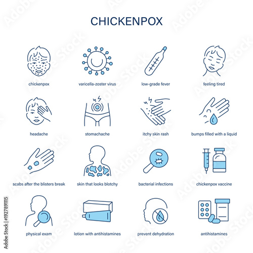 Chickenpox symptoms, diagnostic and treatment vector icon set