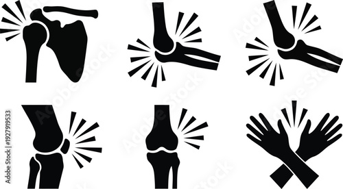 Medical illustrations showing joint pain radiation from different body parts