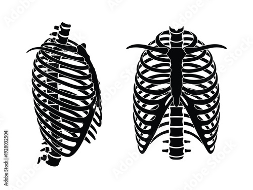 Stylized black silhouettes of two human ribcages against a white background