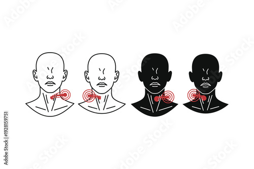 Illustration of neck and shoulder tension points in different head postures