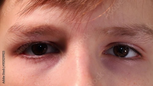 Close-up of a child's eyes and eyebrows, boy blinking and staring at the lens.