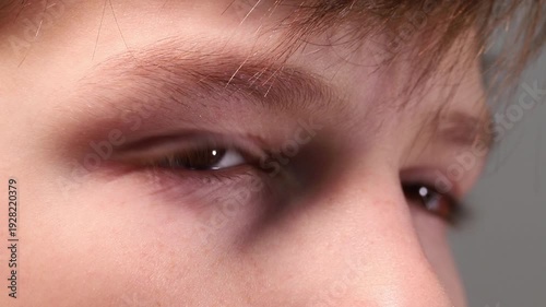 Close-up of a child's eyes and eyebrows, boy blinking and staring at the lens.