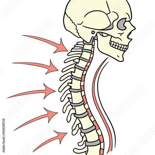 Human skull and spine with curved arrows indicating spinal curvature