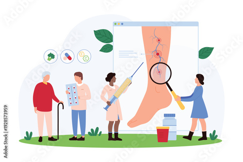 Diagnosis and treatment of varicose veins in elderly by phlebologists, phlebology checkup in hospital. Tiny people diagnose illness of veins on leg with magnifying glass cartoon vector illustration
