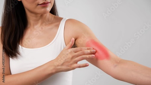 Woman scratching her arm with a red rash or skin irritation on her elbow