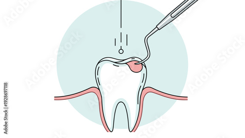 Professional dental procedure involves an instrument examining a white tooth with a small cavity to symbolize oral healthcare and hygiene.