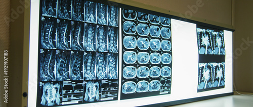 Wallpaper Mural Wall screen with plenty of x-ray scans Torontodigital.ca