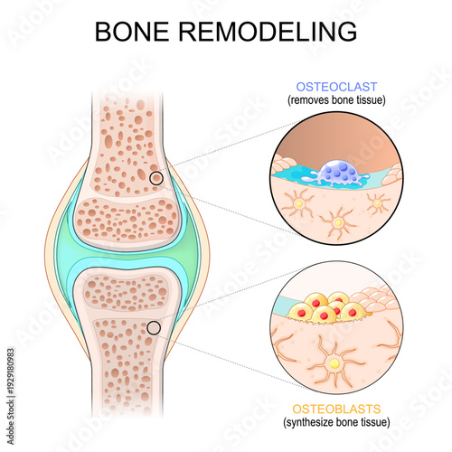 Bone remodeling. Osteoblasts that Synthesize bone tissue, and Osteoclast removes bone tissue.