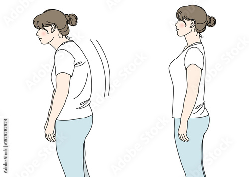 猫背の中年女性と正しい姿勢の女性の比較イラスト 上半身 横向き 横顔 カラー