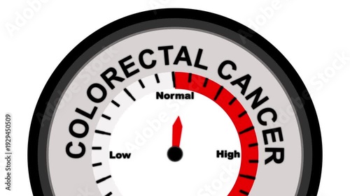 Colorectal Cancer Risk Gauge Showing Low Reading On A White Background colon cancer health gauge