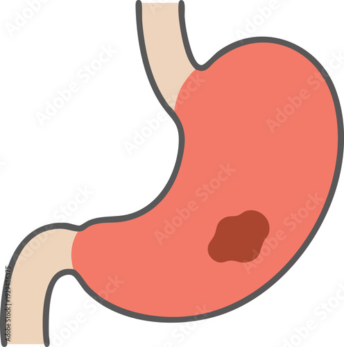 Abstract vector illustration of a human stomach displaying an internal lesion or ulcer, symbolizing digestive health issues, medical conditions, and scientific concepts