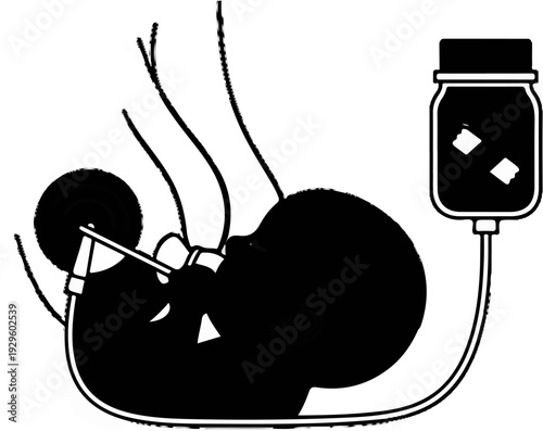 Medical infusion to a fetal human representation, connected to IV drip