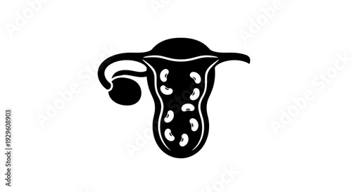 Uterus and Ovary Anatomical Illustration.