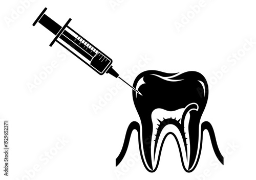 Dental illustration of a syringe injecting anesthesia into a tooth for pain relief during dental procedures