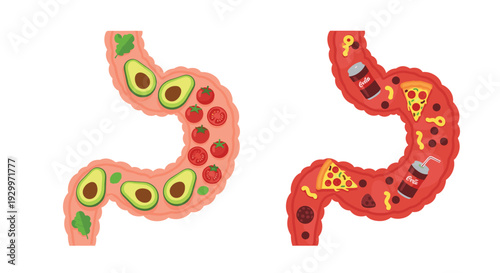 Two stylized human digestive tracts are shown side by side containing healthy vegetables on the left and fast food items on the right.