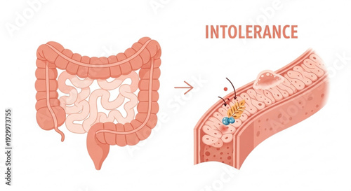 Intestine with food intolerance reaction gut health issues digestive system problems inflammation