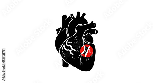 Minimalist black heart graphic with red highlight indicating a potential arterial blockage or