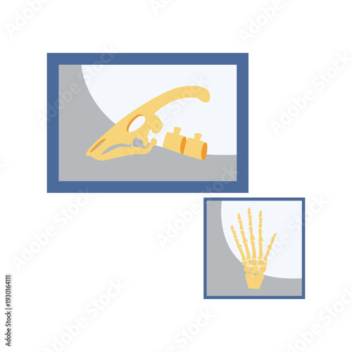  A close-up image of a skull resting beside a long bone on a textured surface.