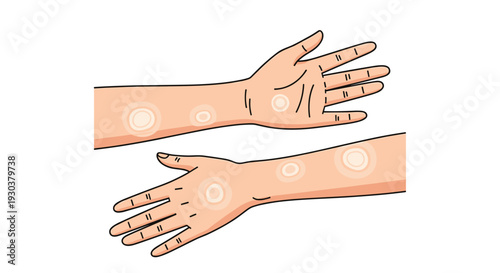 Two arms displayed showing several white circular patches on the skin, potentially indicating vitiligo or another dermatological condition.