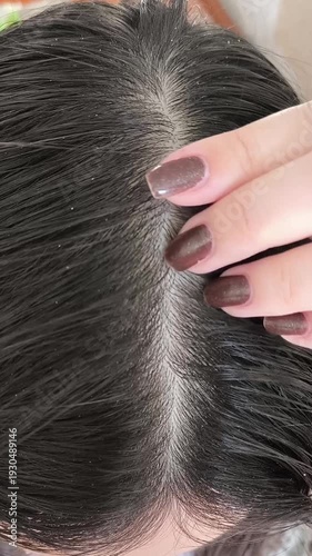 Greasy black hair on a woman's head. A woman touches the oily roots of her hair with dandruff with her hand.