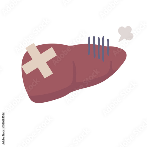 Illustration of an unhealthy-looking liver with a bandage on it