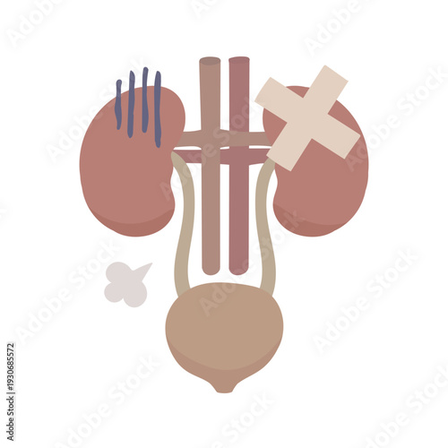 Illustration of an unhealthy-looking kidney and bladder with a bandage attached