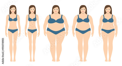 Vector illustration of a woman before and after weight loss. Female body in flat style. Successful diet and sport concept. Slim and fat girls.