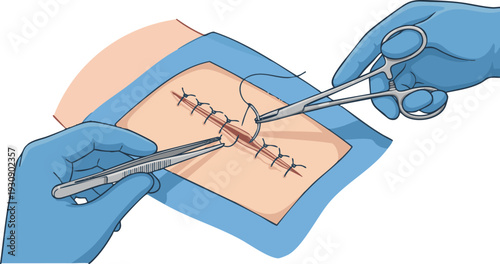 Anatomical illustration of the human pelvis, meticulously detailing the bony structure of the hip and its crucial components within the skeletal system for medical and educational contexts