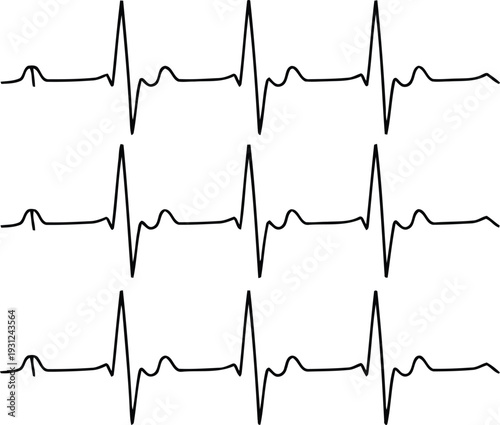 An electrocardiogram reading with multiple waveforms Vector